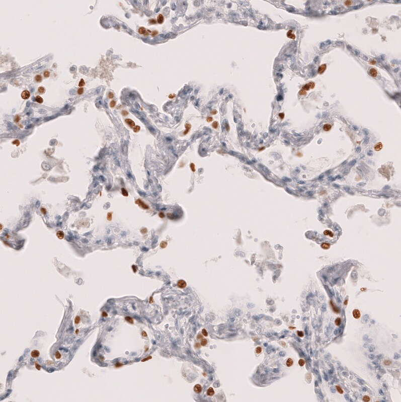 TTF-1 / NKX2-1 Antibody (CL14531) - Azide and BSA Free Immunohistochemistry-Paraffin: TTF-1 / NKX2-1 Antibody [NBP3-44304]