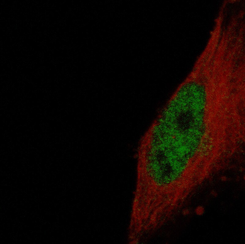 ETV1 Antibody (CL15251) - Azide and BSA Free Immunocytochemistry/ Immunofluorescence: ETV1 Antibody [NBP3-44306]
