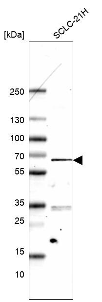 ETV1 Antibody (CL15251) - Azide and BSA Free Western Blot: ETV1 Antibody [NBP3-44306]