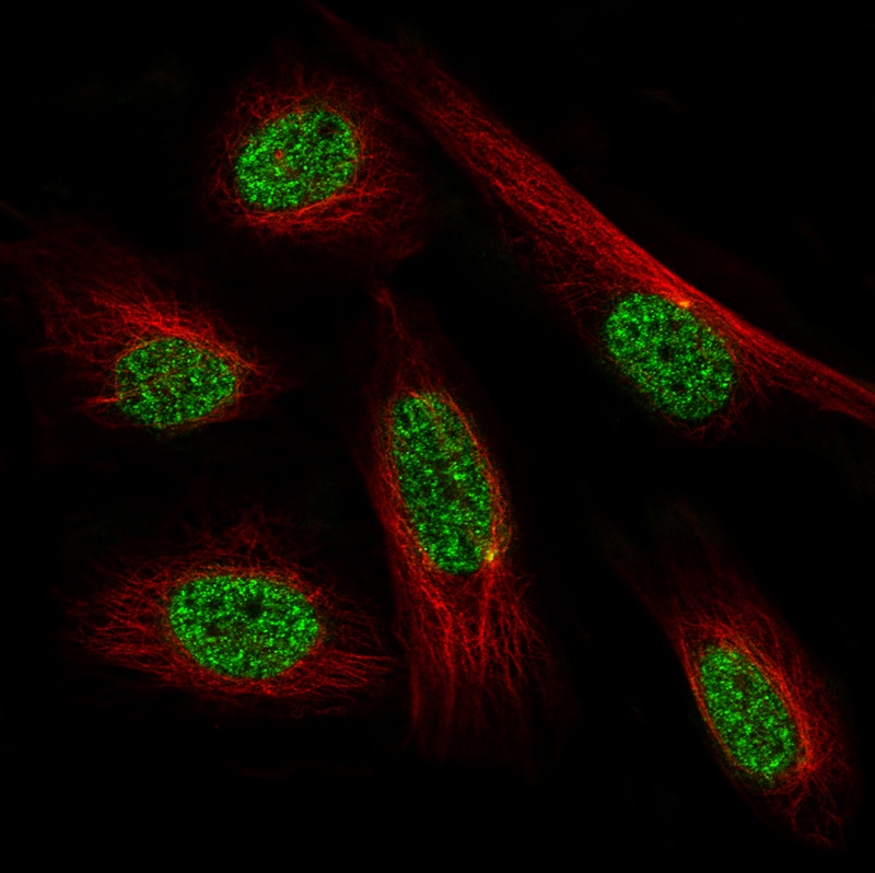 PRRX1 Antibody (CL14471) - Azide and BSA Free Immunocytochemistry/ Immunofluorescence: PRRX1 Antibody [NBP3-44310]
