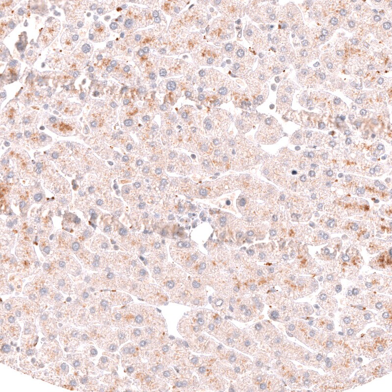 PRRX1 Antibody (CL14471) - Azide and BSA Free Immunohistochemistry-Paraffin: PRRX1 Antibody [NBP3-44310]
