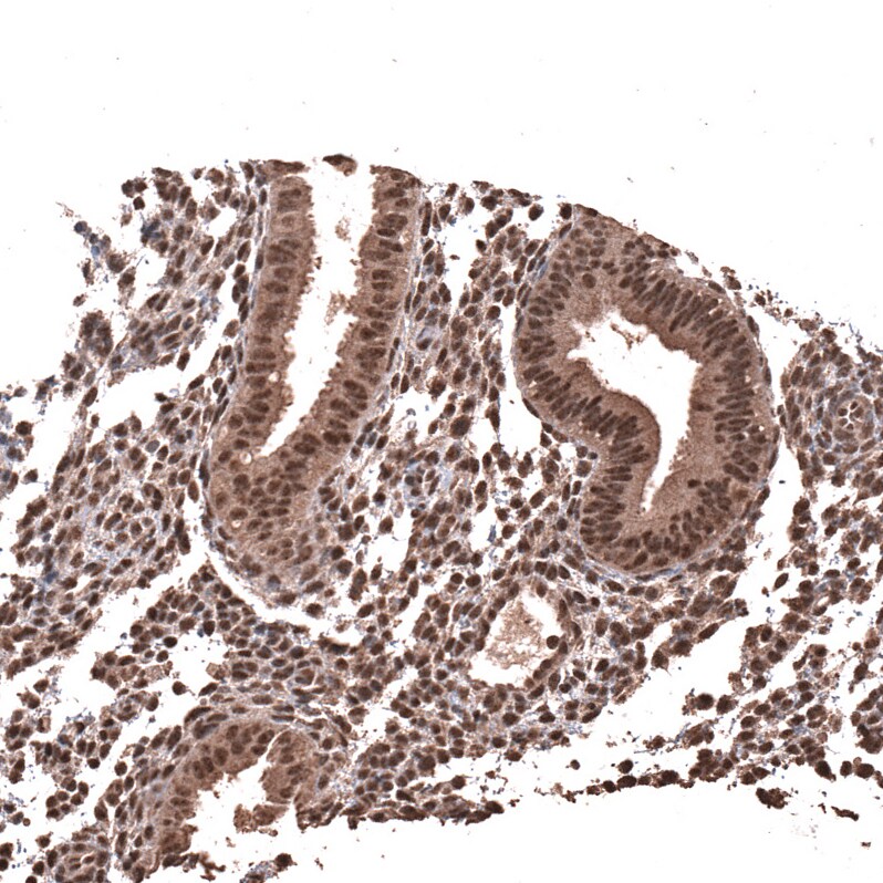 PRRX1 Antibody (CL14471) - Azide and BSA Free Immunohistochemistry-Paraffin: PRRX1 Antibody [NBP3-44310]