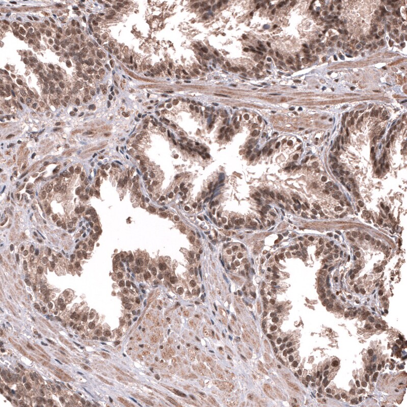 PRRX1 Antibody (CL14471) - Azide and BSA Free Immunohistochemistry-Paraffin: PRRX1 Antibody [NBP3-44310]