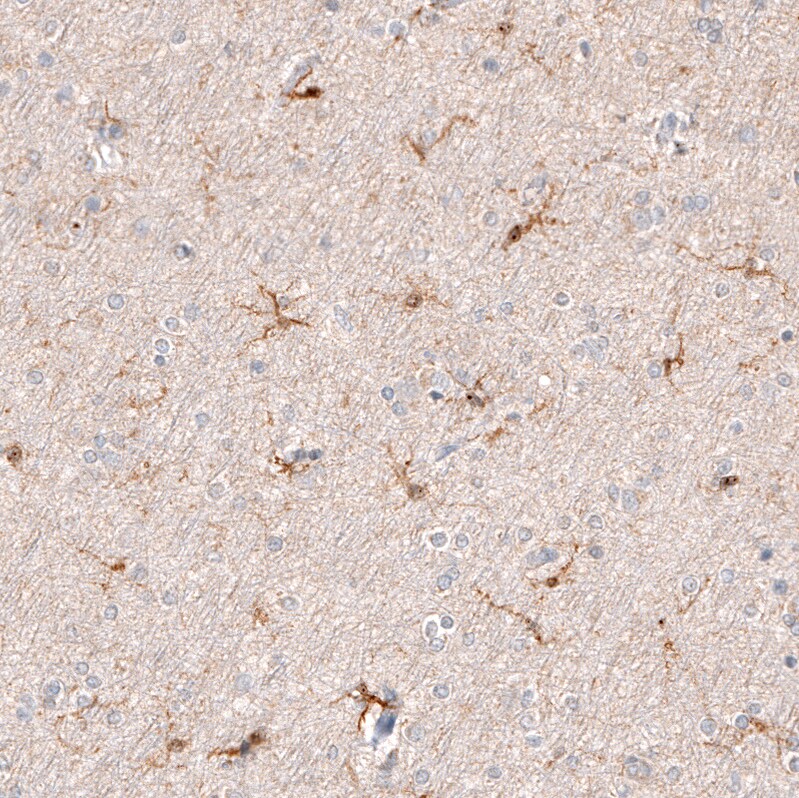 AIF-1/Iba1 Antibody (CL10930) - Azide and BSA Free Immunohistochemistry-Paraffin: AIF-1/Iba1 Antibody [NBP3-44311]