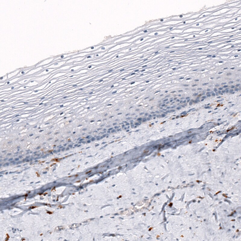 AIF-1/Iba1 Antibody (CL10936) - Azide and BSA Free Immunohistochemistry-Paraffin: AIF-1/Iba1 Antibody [NBP3-44312]