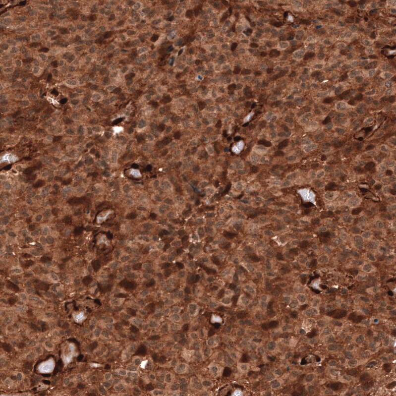 PTEN Antibody (CL11722) - Azide and BSA Free Immunohistochemistry-Paraffin: PTEN Antibody [NBP3-44313]