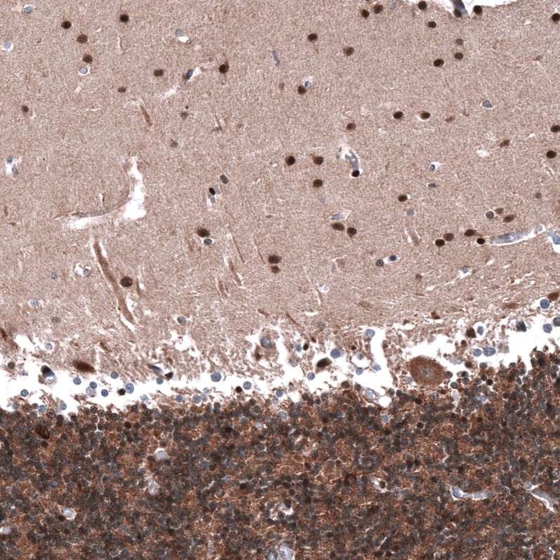 PTEN Antibody (CL11723) - Azide and BSA Free Immunohistochemistry-Paraffin: PTEN Antibody [NBP3-44314]
