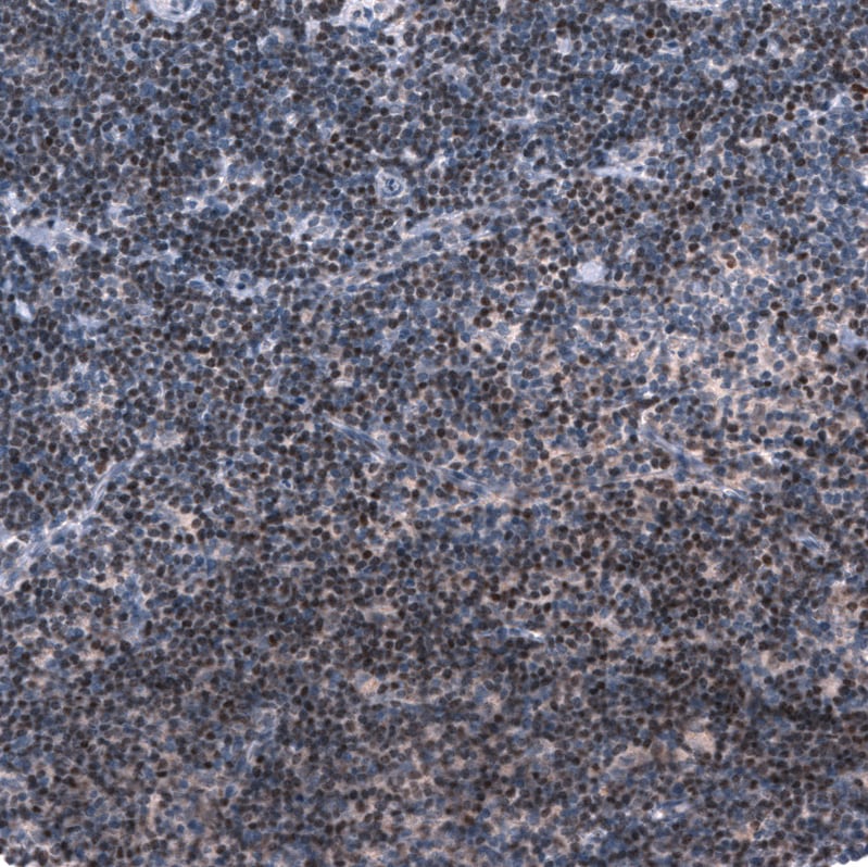 Pax5/BSAP Antibody (CL14548) - Azide and BSA Free Immunohistochemistry-Paraffin: Pax5/BSAP Antibody [NBP3-44316]