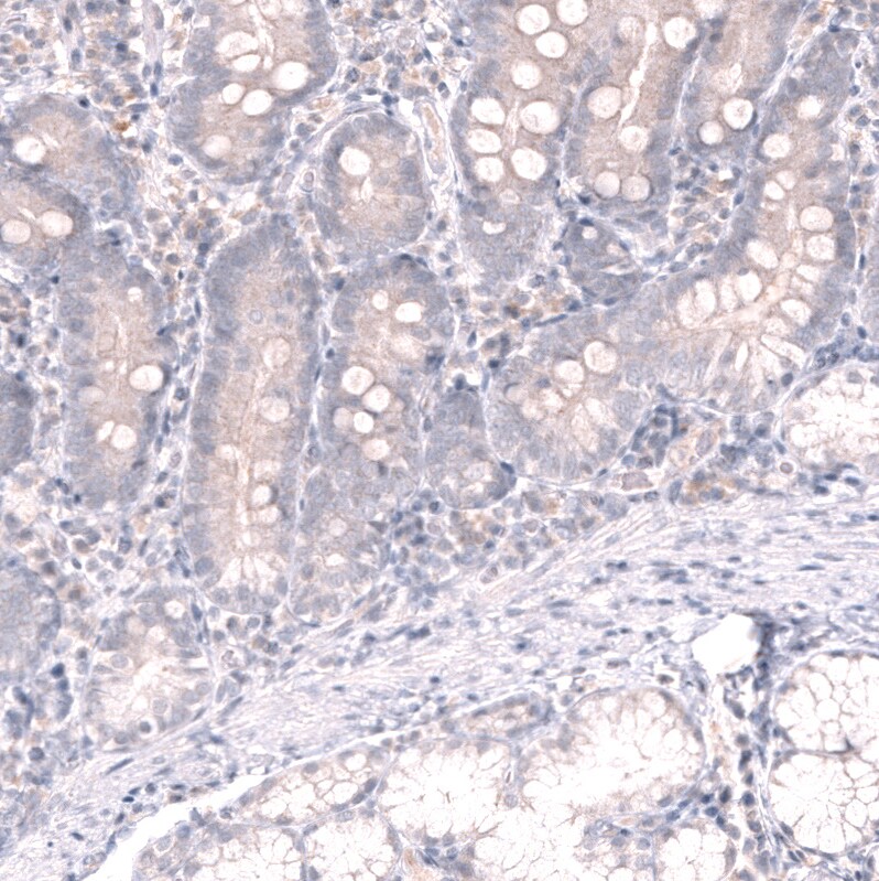 Pax5/BSAP Antibody (CL14548) - Azide and BSA Free Immunohistochemistry-Paraffin: Pax5/BSAP Antibody [NBP3-44316]