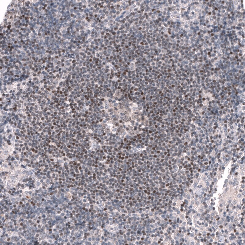 Pax5/BSAP Antibody (CL14548) - Azide and BSA Free Immunohistochemistry-Paraffin: Pax5/BSAP Antibody [NBP3-44316]