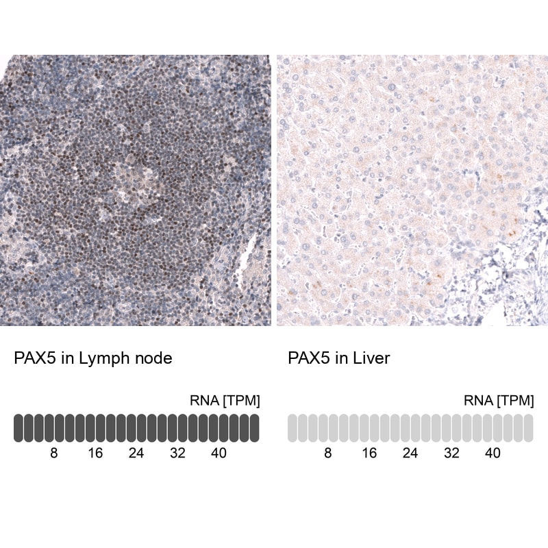 Pax5/BSAP Antibody (CL14548) - Azide and BSA Free Immunohistochemistry-Paraffin: Pax5/BSAP Antibody [NBP3-44316]