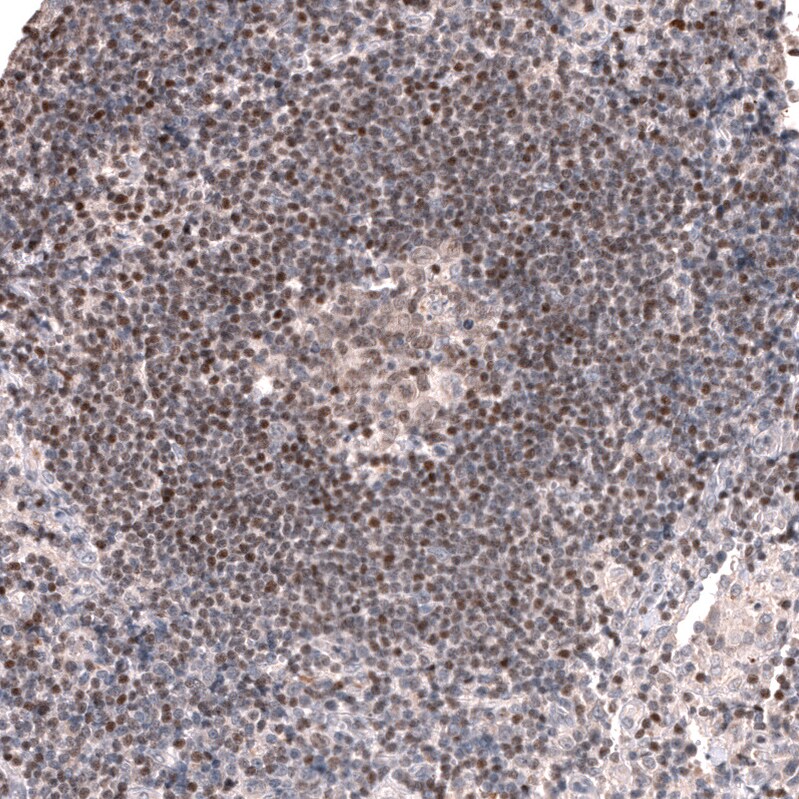 Pax5/BSAP Antibody (CL14550) - Azide and BSA Free Immunohistochemistry-Paraffin: Pax5/BSAP Antibody [NBP3-44317]
