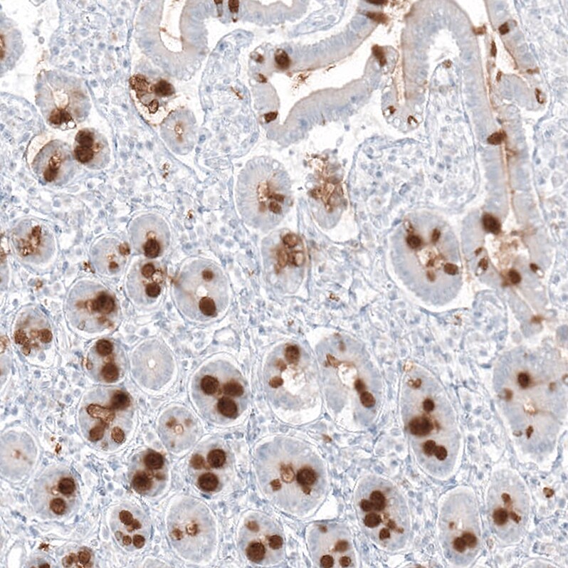 MUC2 Antibody (CL9148) - Azide and BSA Free Immunohistochemistry-Paraffin: MUC2 Antibody [NBP3-44318]