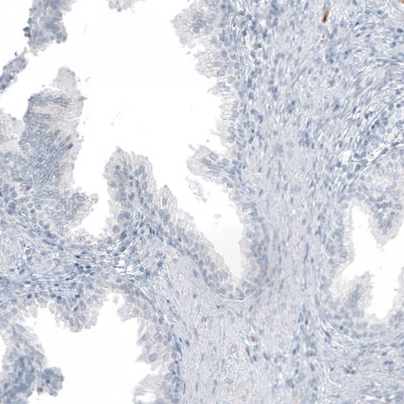 MUC2 Antibody (CL9148) - Azide and BSA Free Immunohistochemistry-Paraffin: MUC2 Antibody [NBP3-44318]
