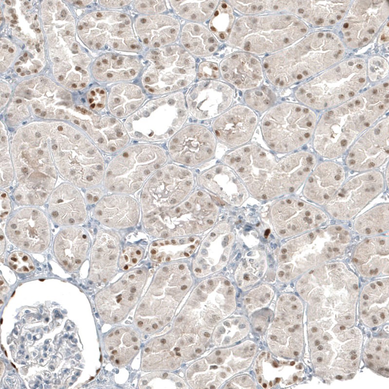 PAX8 Antibody (CL7834) - Azide and BSA Free Immunohistochemistry-Paraffin: PAX8 Antibody [NBP3-44319]