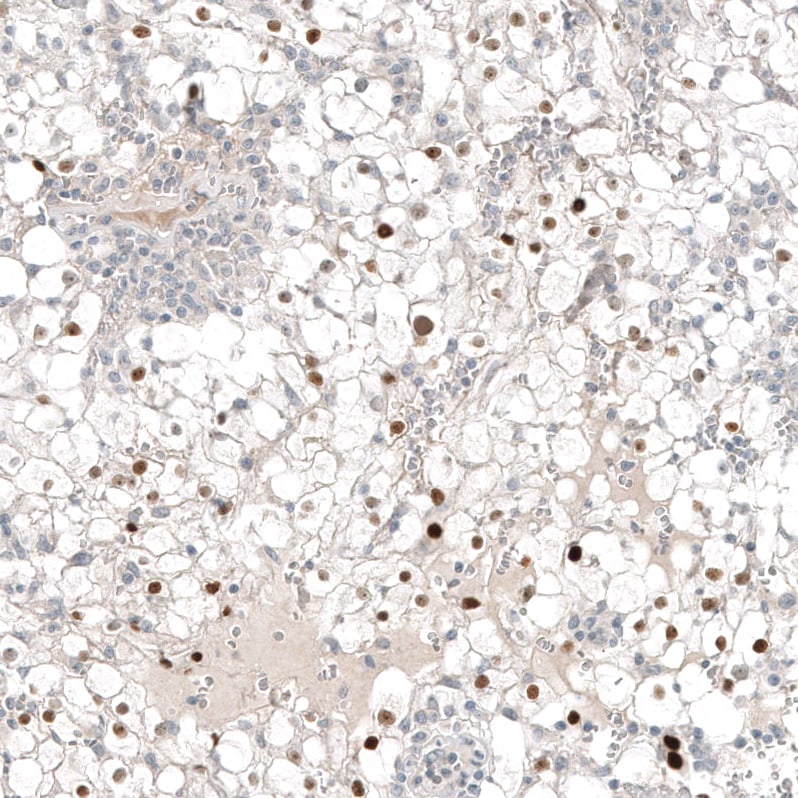 PAX8 Antibody (CL7834) - Azide and BSA Free Immunohistochemistry-Paraffin: PAX8 Antibody [NBP3-44319]