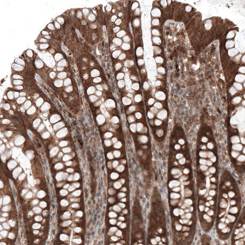 Bax Antibody (CL7919) - Azide and BSA Free Immunohistochemistry-Paraffin: Bax Antibody [NBP3-44320]