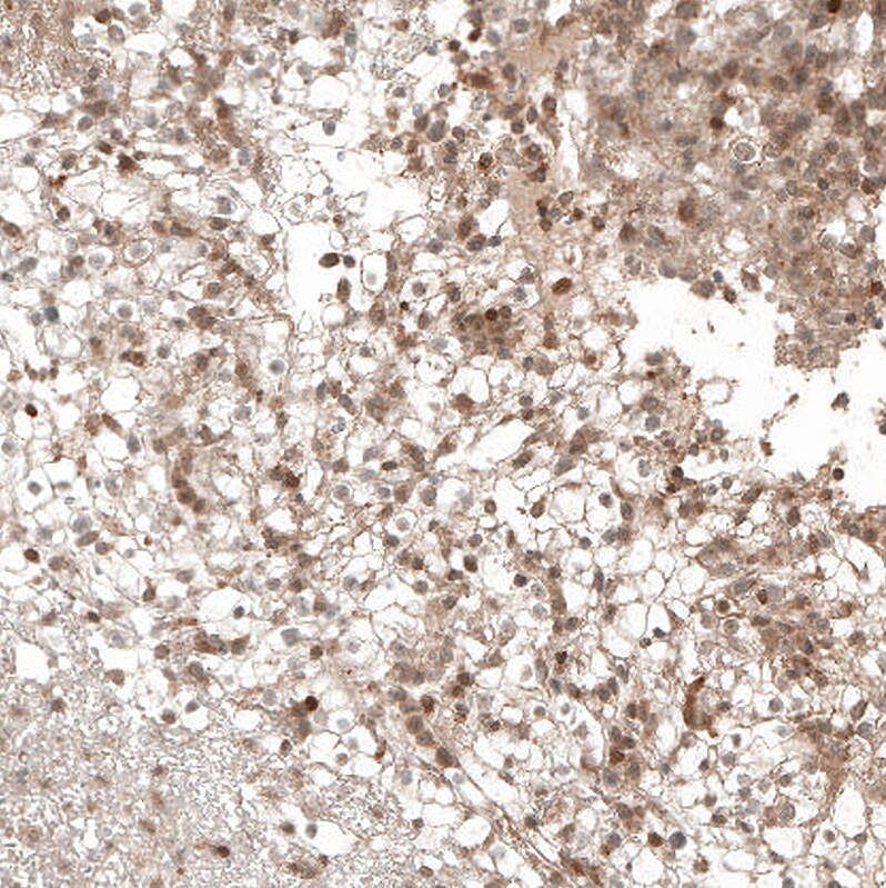 Bax Antibody (CL7919) - Azide and BSA Free Immunohistochemistry-Paraffin: Bax Antibody [NBP3-44320]
