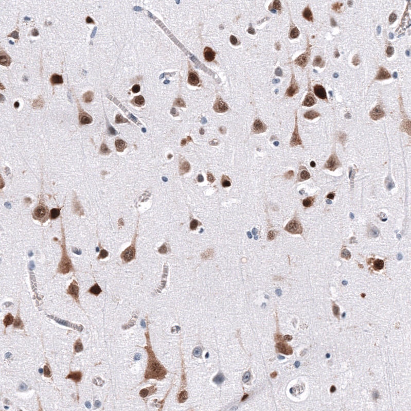 ELAVL2 Antibody (CL15323) - Azide and BSA Free Immunohistochemistry-Paraffin: ELAVL2 Antibody [NBP3-44321]