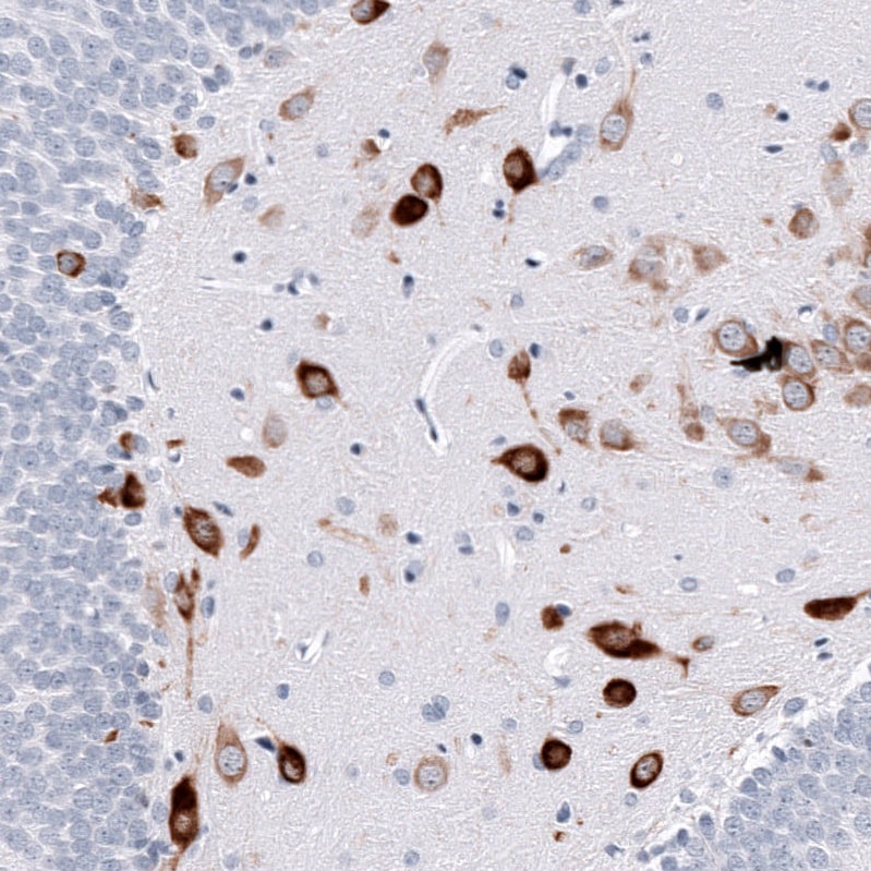 ELAVL2 Antibody (CL15323) - Azide and BSA Free Immunohistochemistry-Paraffin: ELAVL2 Antibody [NBP3-44321]