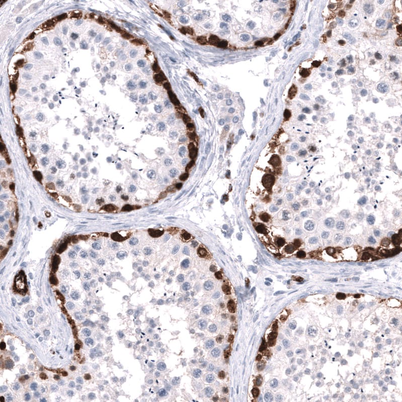 ELAVL2 Antibody (CL15323) - Azide and BSA Free Immunohistochemistry-Paraffin: ELAVL2 Antibody [NBP3-44321]