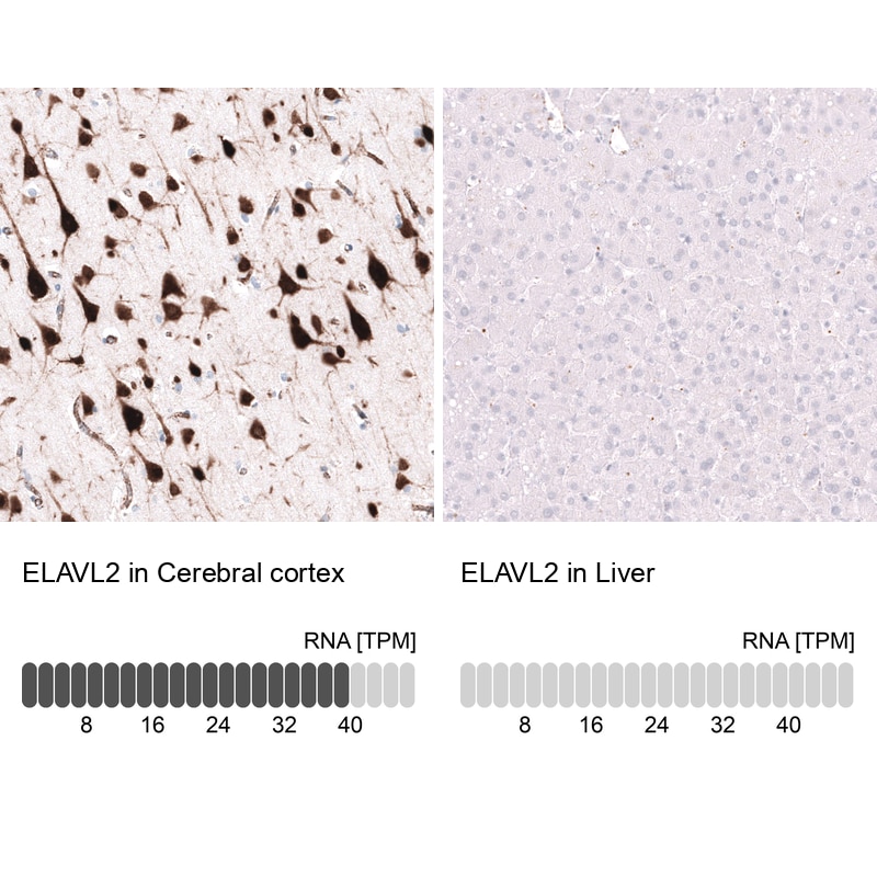 ELAVL2 Antibody (CL15329) - Azide and BSA Free Immunohistochemistry-Paraffin: ELAVL2 Antibody [NBP3-44322]