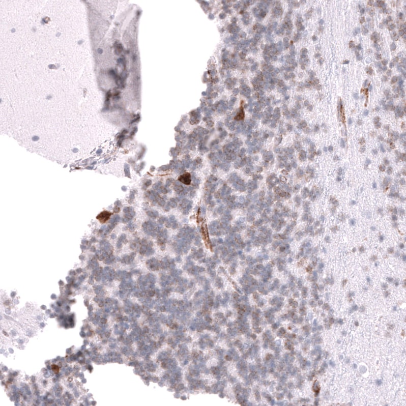 ELAVL2 Antibody (CL15329) - Azide and BSA Free Immunohistochemistry-Paraffin: ELAVL2 Antibody [NBP3-44322]