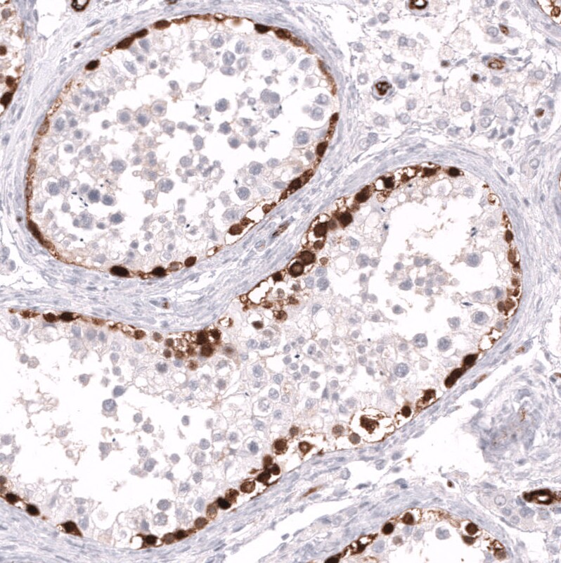 ELAVL2 Antibody (CL15329) - Azide and BSA Free Immunohistochemistry-Paraffin: ELAVL2 Antibody [NBP3-44322]