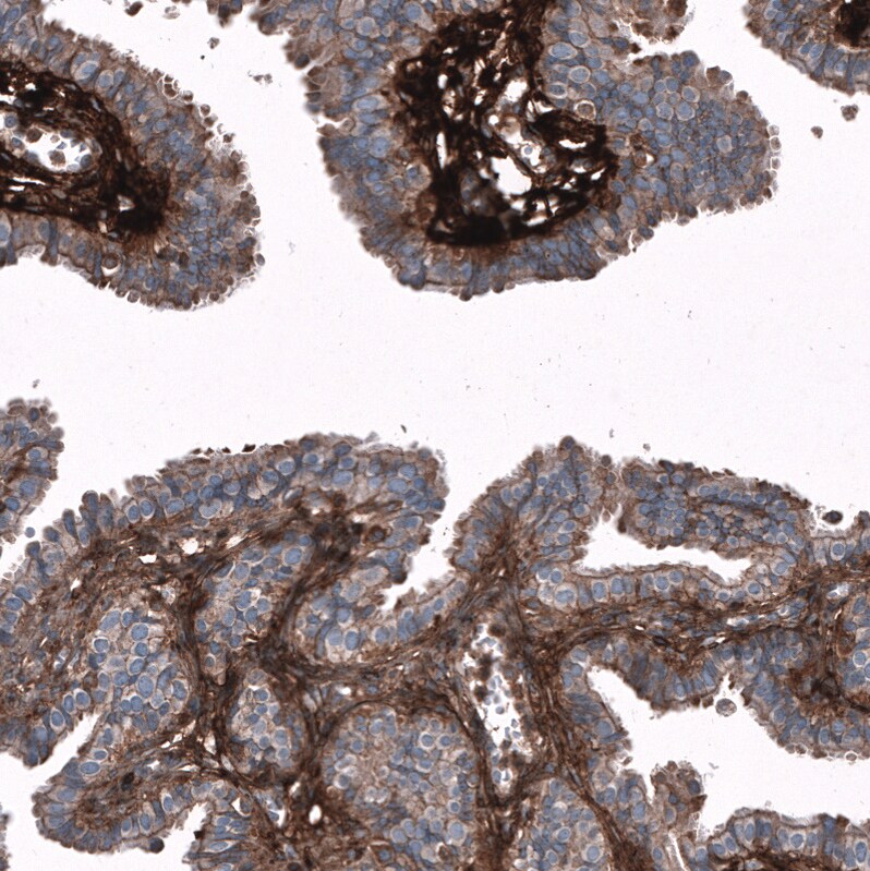 Periostin/OSF-2 Antibody (CL12090) - Azide and BSA Free Immunohistochemistry-Paraffin: Periostin/OSF-2 Antibody [NBP3-44324]