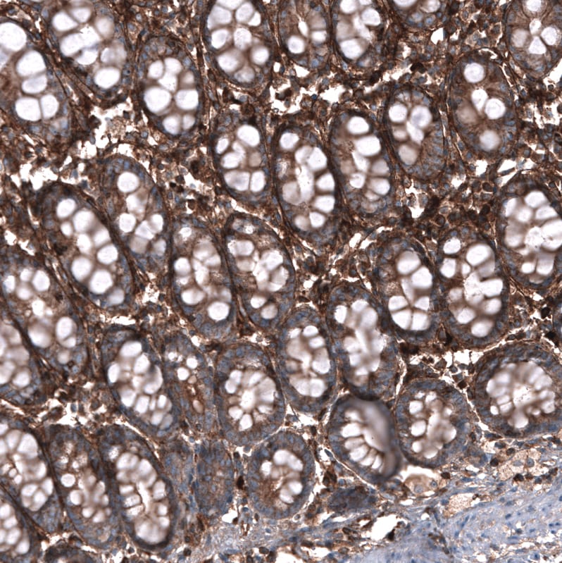 Periostin/OSF-2 Antibody (CL12090) - Azide and BSA Free Immunohistochemistry-Paraffin: Periostin/OSF-2 Antibody [NBP3-44324]