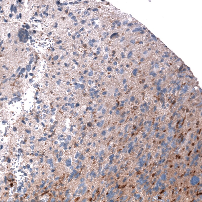 Periostin/OSF-2 Antibody (CL12090) - Azide and BSA Free Immunohistochemistry-Paraffin: Periostin/OSF-2 Antibody [NBP3-44324]
