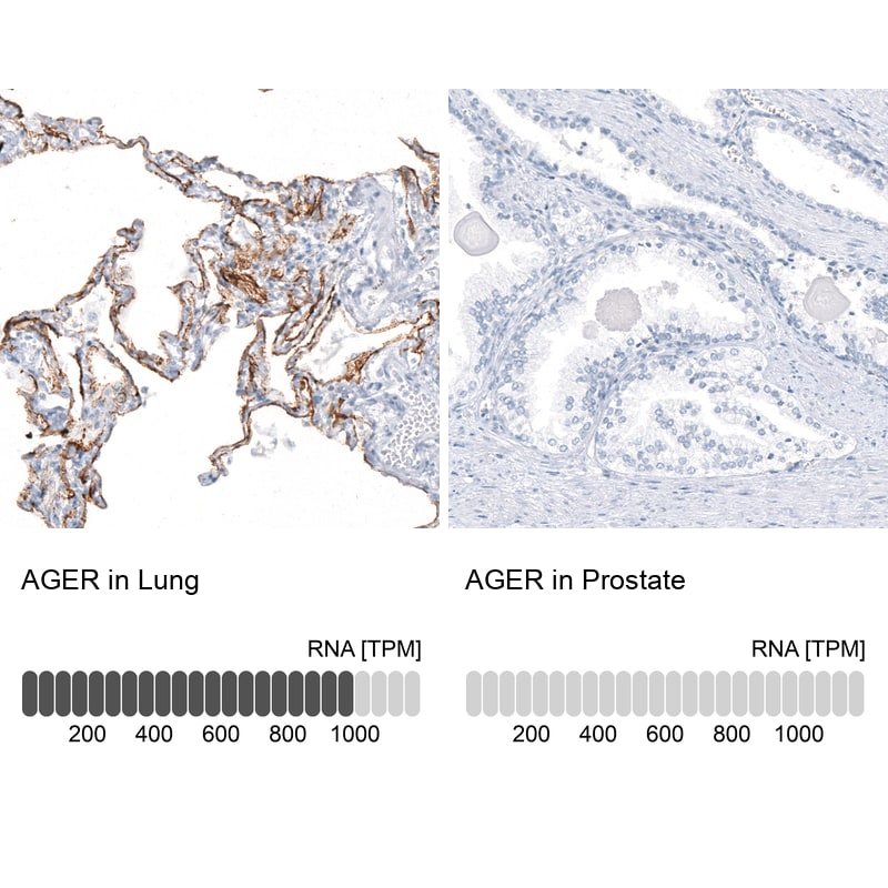 AGER Antibody (CL10591) - Azide and BSA Free Immunohistochemistry-Paraffin: AGER Antibody [NBP3-44325]