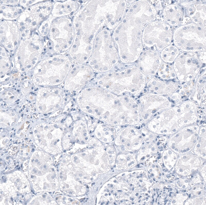 AGER Antibody (CL10591) - Azide and BSA Free Immunohistochemistry-Paraffin: AGER Antibody [NBP3-44325]