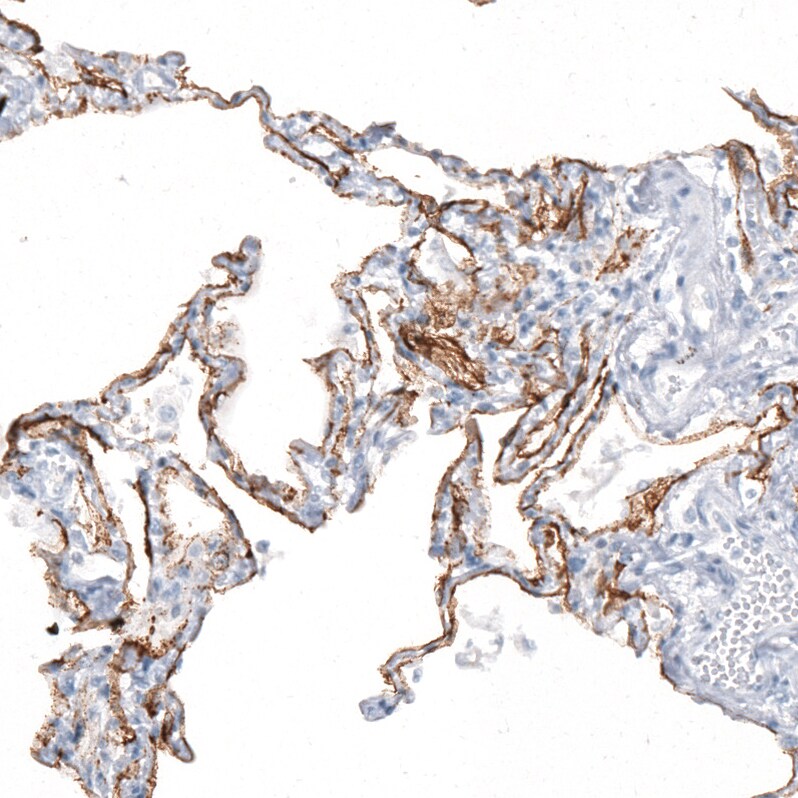 AGER Antibody (CL10591) - Azide and BSA Free Immunohistochemistry-Paraffin: AGER Antibody [NBP3-44325]