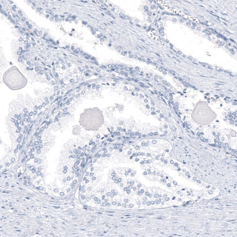 AGER Antibody (CL10591) - Azide and BSA Free Immunohistochemistry-Paraffin: AGER Antibody [NBP3-44325]