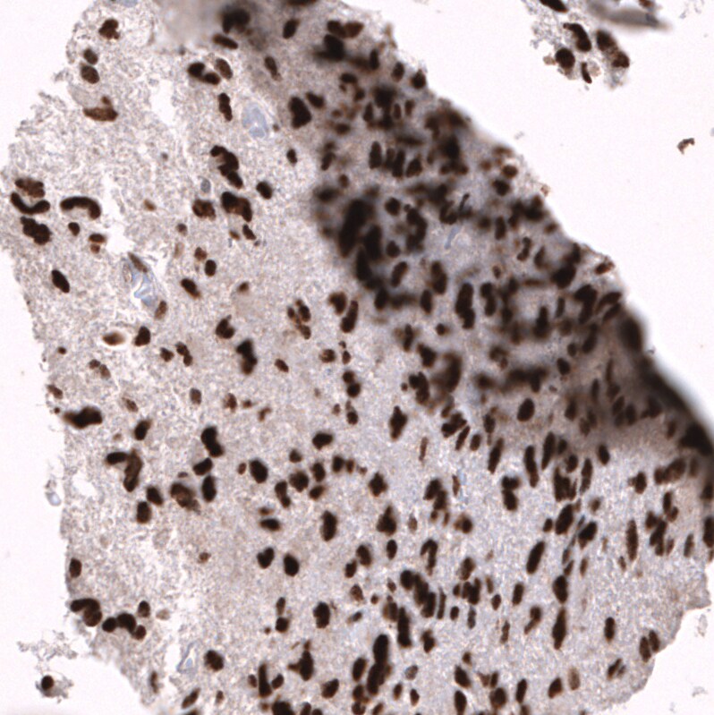 EZH2/KMT6 Antibody (CL11915) - Azide and BSA Free Immunohistochemistry-Paraffin: EZH2/KMT6 Antibody [NBP3-44326]