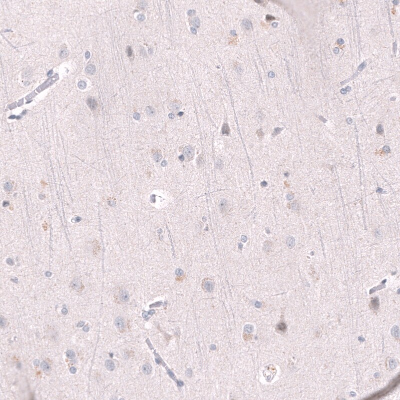 EZH2/KMT6 Antibody (CL11915) - Azide and BSA Free Immunohistochemistry-Paraffin: EZH2/KMT6 Antibody [NBP3-44326]