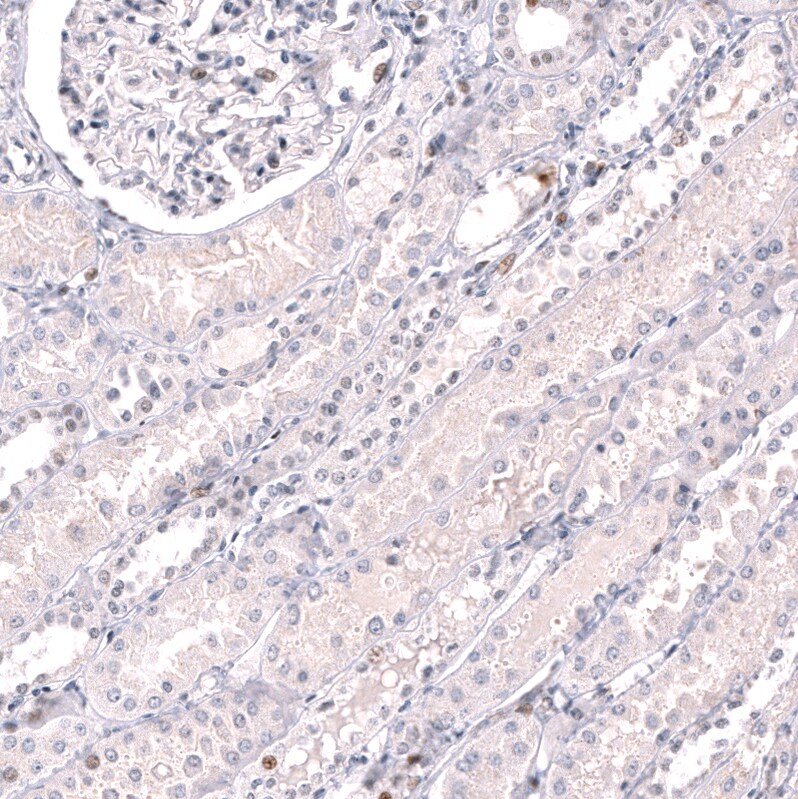 EZH2/KMT6 Antibody (CL11915) - Azide and BSA Free Immunohistochemistry-Paraffin: EZH2/KMT6 Antibody [NBP3-44326]