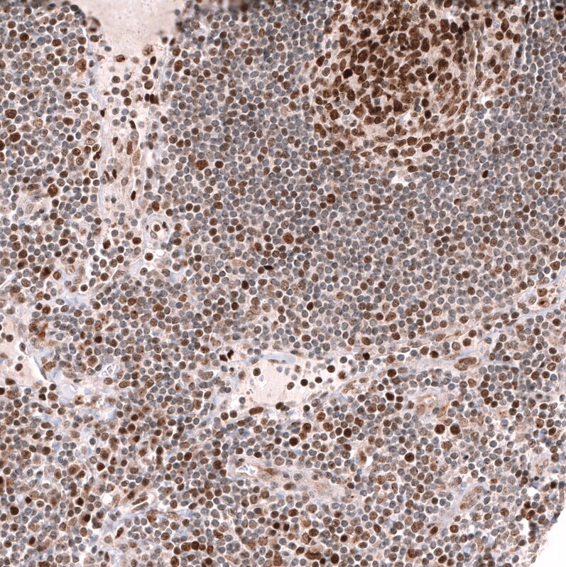 EZH2/KMT6 Antibody (CL11915) - Azide and BSA Free Immunohistochemistry-Paraffin: EZH2/KMT6 Antibody [NBP3-44326]