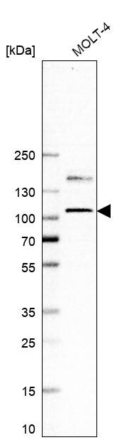 EZH2/KMT6 Antibody (CL11915) - Azide and BSA Free Western Blot: EZH2/KMT6 Antibody [NBP3-44326]