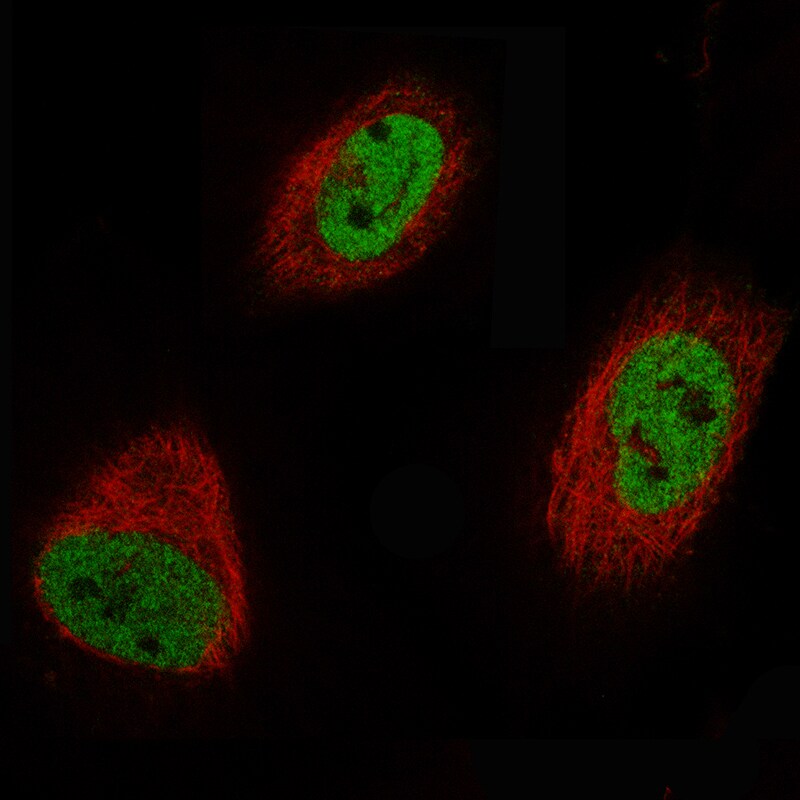 EZH2/KMT6 Antibody (CL11915) - Azide and BSA Free Immunocytochemistry/ Immunofluorescence: EZH2/KMT6 Antibody [NBP3-44326]