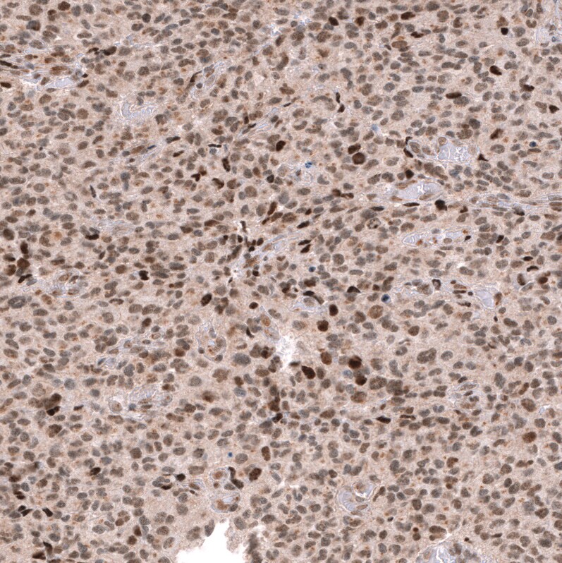 EZH2/KMT6 Antibody (CL11945) - Azide and BSA Free Immunohistochemistry-Paraffin: EZH2/KMT6 Antibody [NBP3-44327]