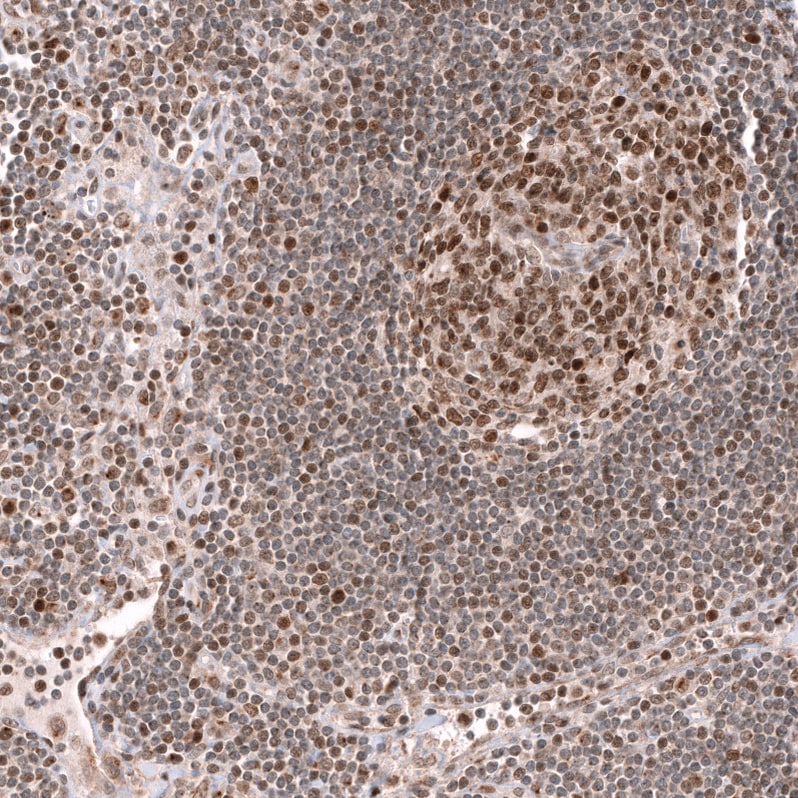 EZH2/KMT6 Antibody (CL11945) - Azide and BSA Free Immunohistochemistry-Paraffin: EZH2/KMT6 Antibody [NBP3-44327]