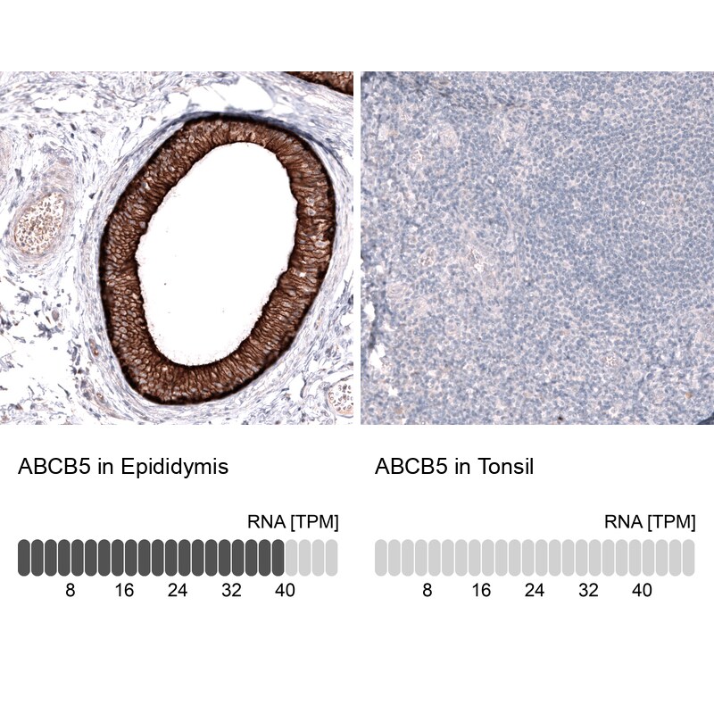 ABCB5 Antibody (CL13618) - Azide and BSA Free Immunohistochemistry-Paraffin: ABCB5 Antibody [NBP3-44328]