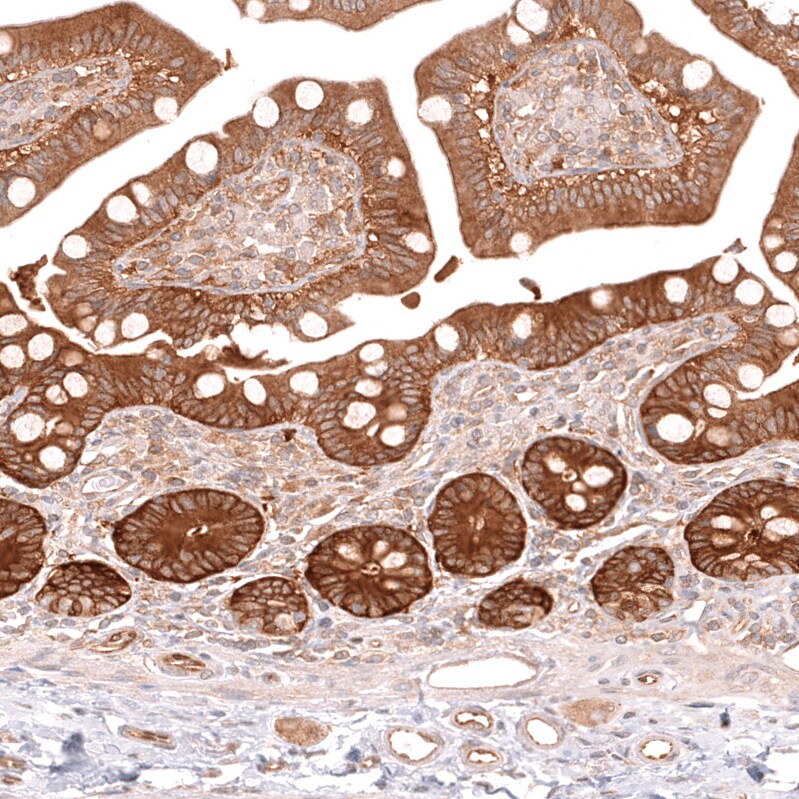 TYKi Antibody (CL14479) - Azide and BSA Free Immunohistochemistry-Paraffin: TYKi Antibody [NBP3-44329]