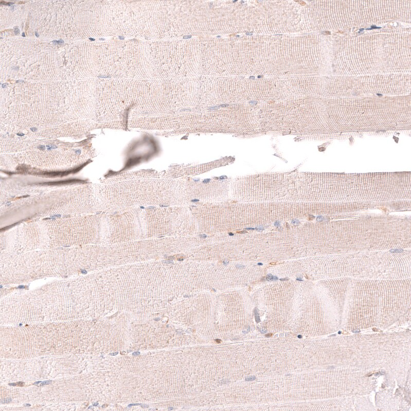 TYKi Antibody (CL14479) - Azide and BSA Free Immunohistochemistry-Paraffin: TYKi Antibody [NBP3-44329]