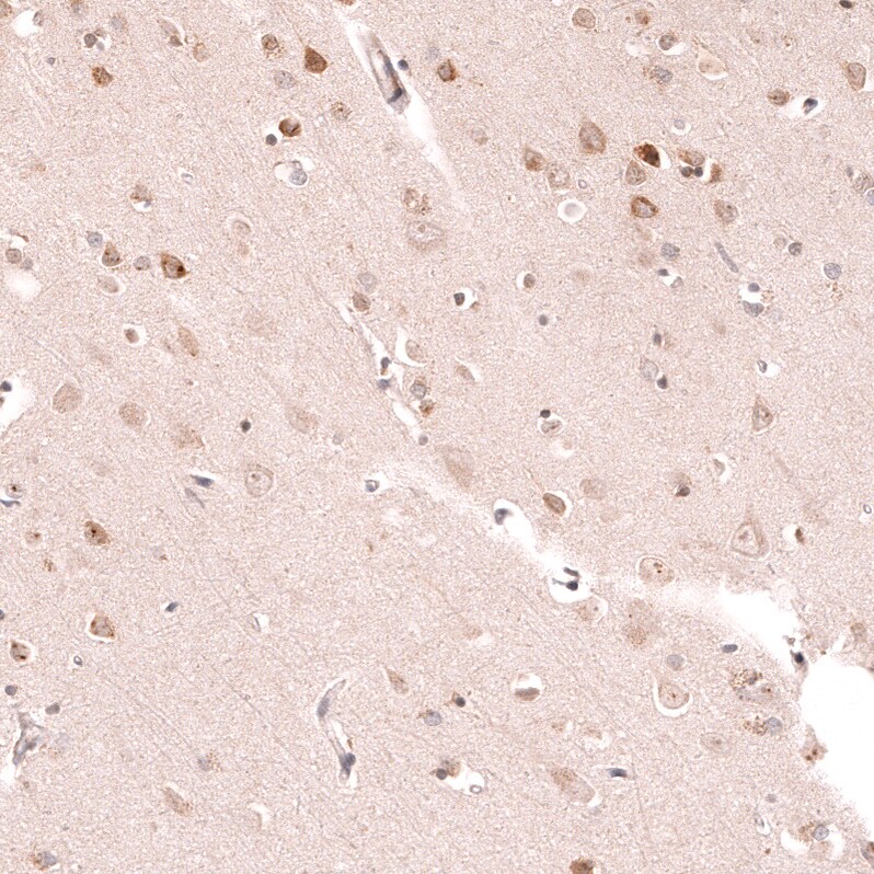 R-Spondin 2 Antibody (CL14321) - Azide and BSA Free Immunohistochemistry-Paraffin: R-Spondin 2 Antibody [NBP3-44331]