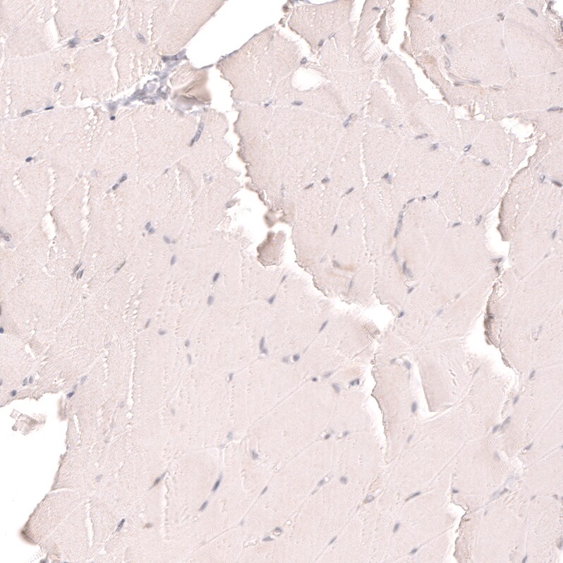 R-Spondin 2 Antibody (CL14321) - Azide and BSA Free Immunohistochemistry-Paraffin: R-Spondin 2 Antibody [NBP3-44331]