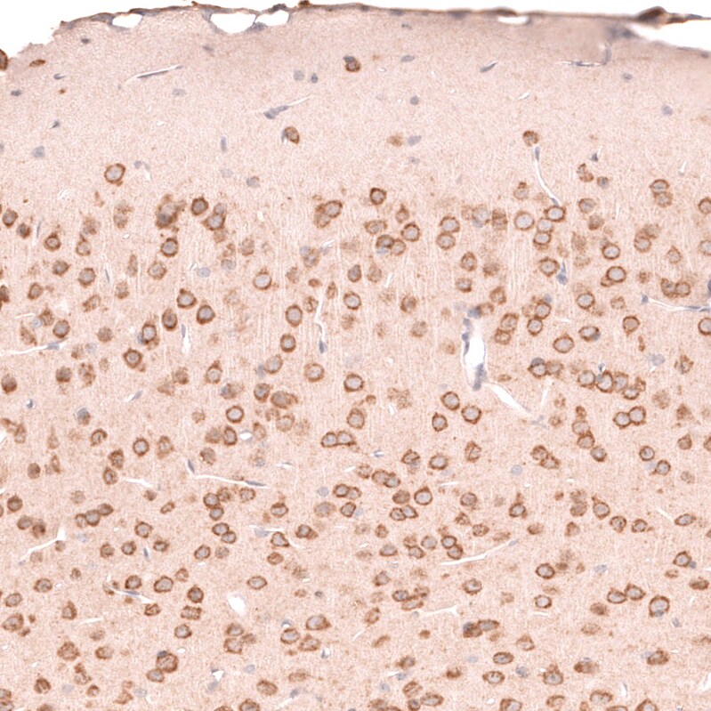 R-Spondin 2 Antibody (CL14321) - Azide and BSA Free Immunohistochemistry-Paraffin: R-Spondin 2 Antibody [NBP3-44331]