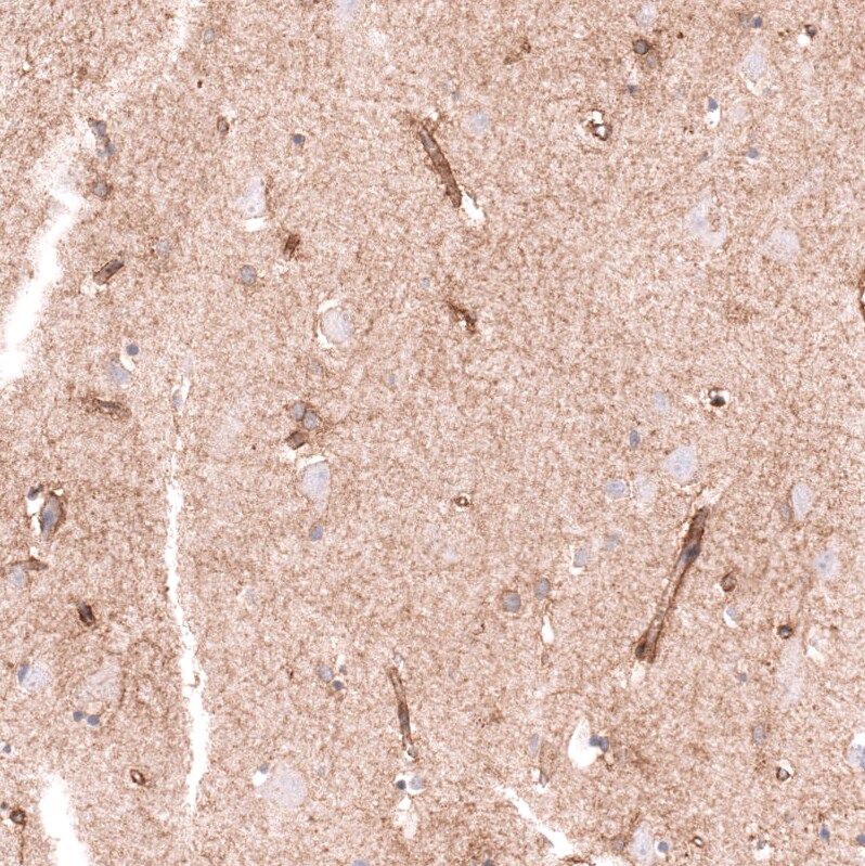 CLEC10A/CD301 Antibody (CL15513) - Azide and BSA Free Immunohistochemistry-Paraffin: CLEC10A/CD301 Antibody [NBP3-44333]